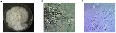 Antagonistic activity of two Bacillus strains against Fusarium oxysporum f. sp. capsici (FOC-1) causing Fusarium wilt and growth promotion activity of chili plant